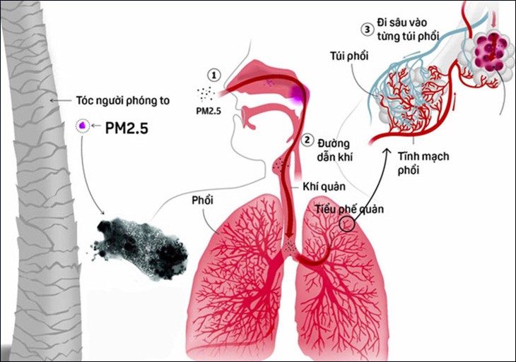 Bụi mịn PM2.5 là gì? Tác hại và cách phòng tránh bụi mịn PM2.5 bạn nên biết