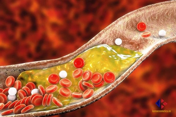 Những hiểu lầm và sự thật về việc tăng cholesterol bạn cần biết