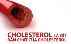 Cholesterol là gì? Nhóm thực phẩm giàu cholesterol tốt và xấu