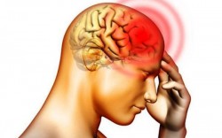 Tai biến là gì? tổng quan về bệnh tai biến mạch máu não và các di chứng