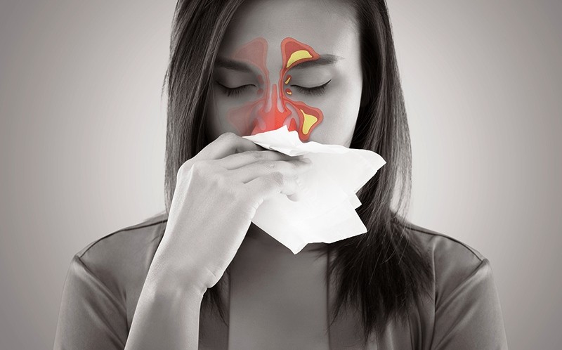 Bị chảy dịch mũi sau là bệnh gì, có nguy hiểm không? Điều trị thế nào?