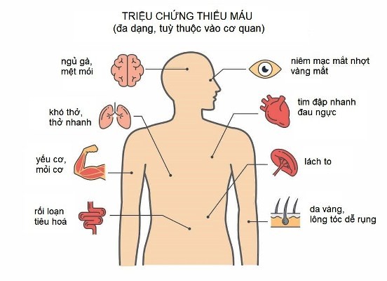 Thiếu máu não là gì? Thiếu máu não có nguy hiểm không?