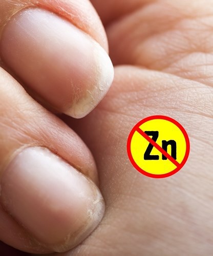 7 Dấu hiệu ở bàn tay chỉ ra bạn đang có vấn đề về sức khỏe