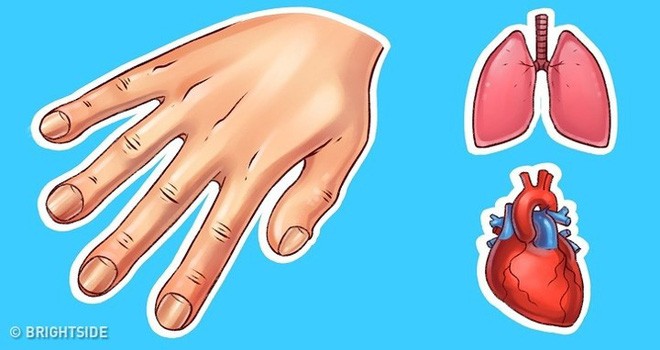 7 Dấu hiệu ở bàn tay chỉ ra bạn đang có vấn đề về sức khỏe cần lưu ý