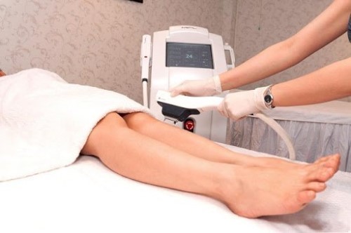 Công nghệ triệt lông Diode Laser là gì và có thật sự hiệu quả hay không?