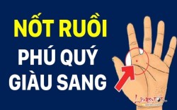 Có nốt ruồi này ở bàn tay không phú quý thì cũng giàu sang